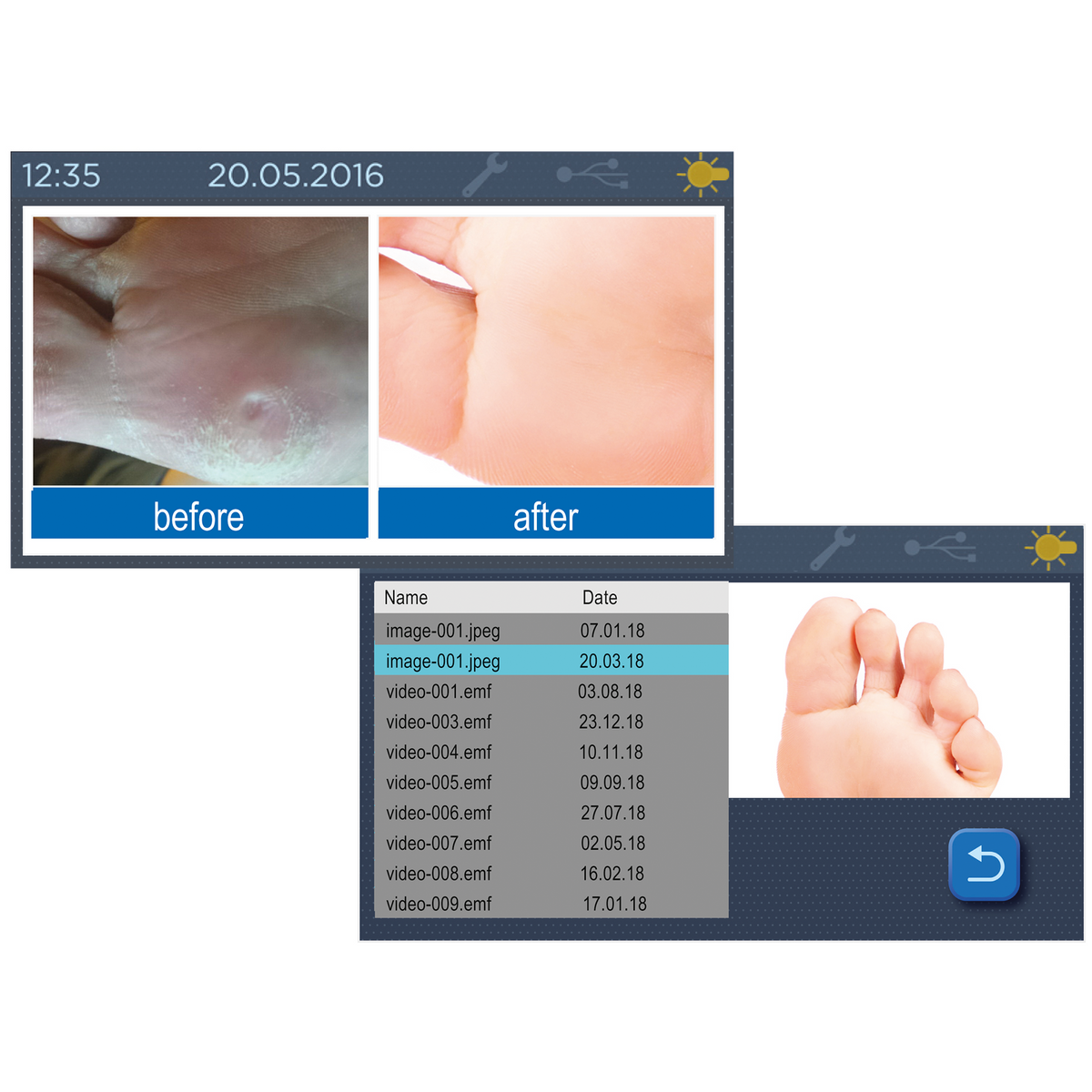 HADEWE Medeas Plus – Absauggerät mit Touchscreen & LED-Handstück | Podologie