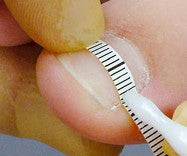 Erkodent Onyclip Streifen – Nachfüllpackung 8 Streifen (Nagelkorrektursystem)